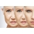 Anti-Aging Nedir?