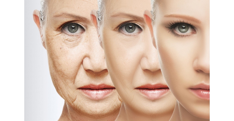 Anti-Aging Nedir?